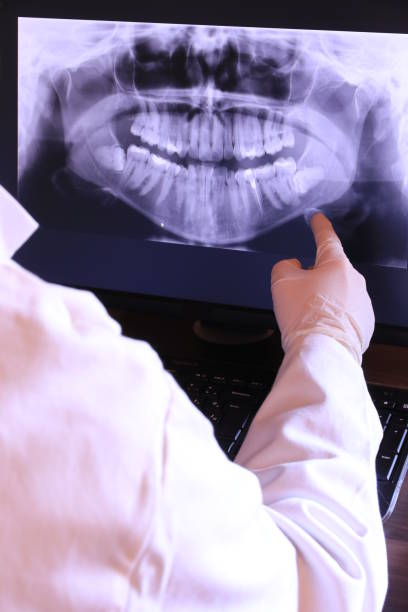 Best Emergency Gum Treatment in Channel Lake, IL