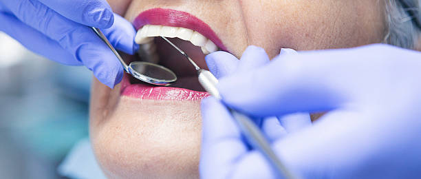 Best Emergency Tooth Extraction in Channel Lake, IL
